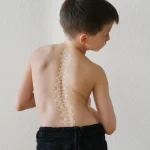 Scoliose et mal de dos : le guide complet pour soulager votre dos naturellement (2026)